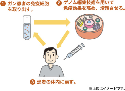 1ガン患者の免疫細胞を取り出す。 2ゲノム編集技術を用いて免疫効果を高め、増殖させる。 3患者の体内に戻す。